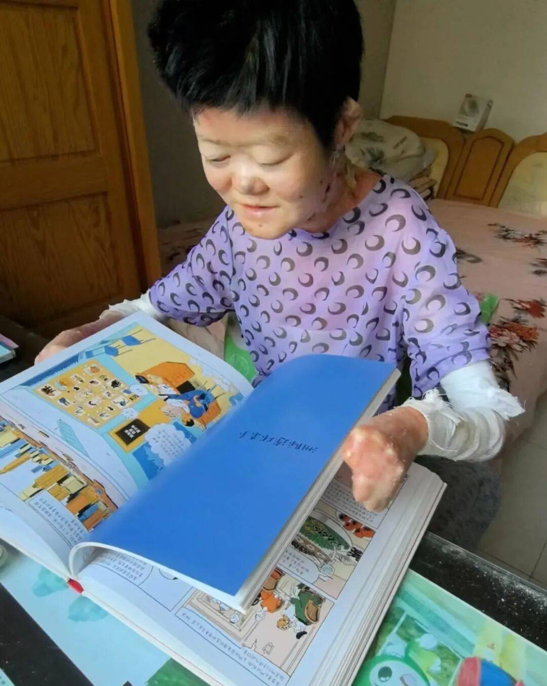 医生断言“活不过2岁”的郑州罕见病女孩，24岁“带伤出征”，开启西藏之行