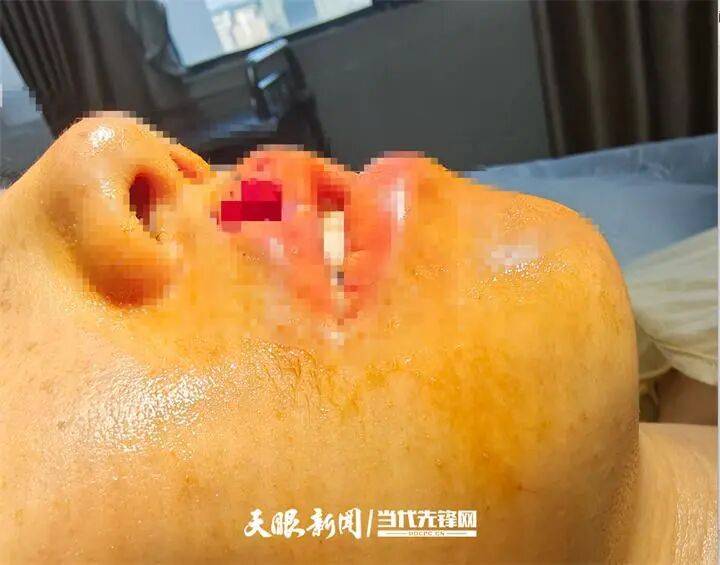 女子上门代喂被100多斤阿拉斯加犬咬伤毁容,牙槽骨和牙齿都被撕咬脱落,狗主人却称→