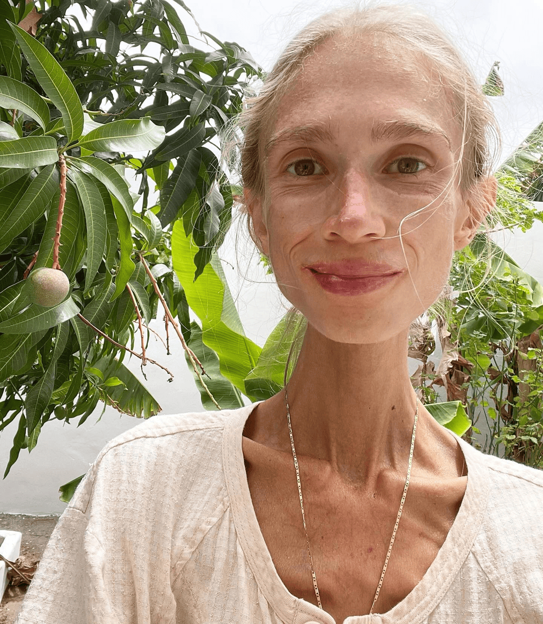 坚持只吃水果8年,27岁波兰女子巴厘岛酒店去世:体重仅22公斤,指甲变黄牙齿腐烂