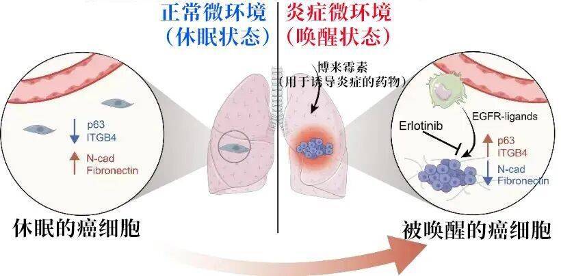 长期炎症会“唤醒”癌细胞!这份抗炎指南每个人都该看看